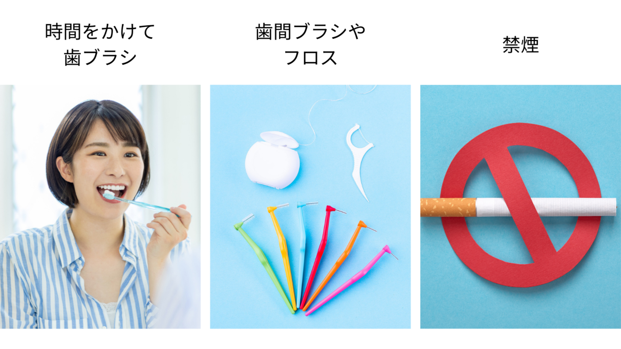 時間をかけて歯ブラシ・歯間ブラシやフロス・禁煙