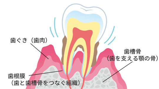 歯周病治療の方法〜歯周病の治し方とは？ - 名古屋市のつゆくさ歯科